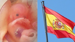 Hiszpański TK przez 11 lat nie zdążył orzec ws. aborcji. Prawnicy skarżą go do Strasbourga - miniaturka