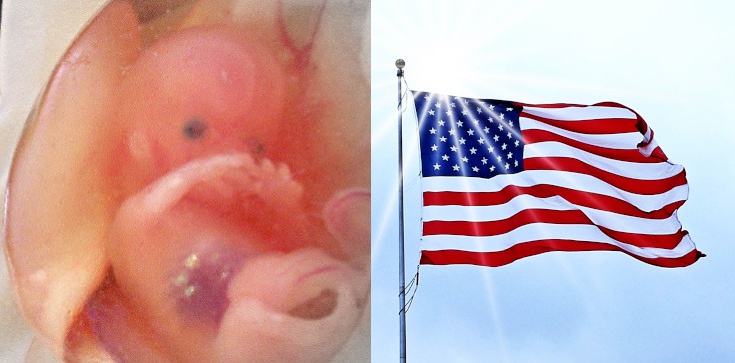 USA. Ohio wprowadza zakaz aborcji od poczęcia - zdjęcie